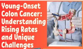 Young-Onset Colon Cancer: Understanding the Rising Rates and Unique Challenges