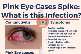 Pink Eyes Cases Spike: What is this Infection?